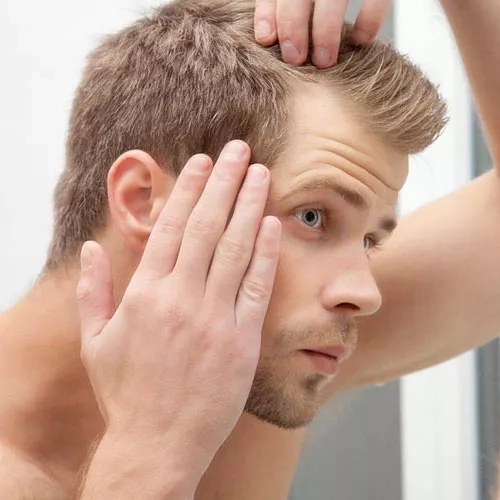 راه های جلوگیری از ریزش موی شدید