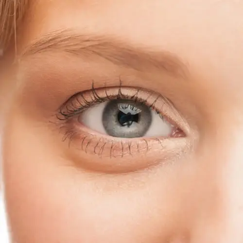 5 روش درمان پف زیر چشم