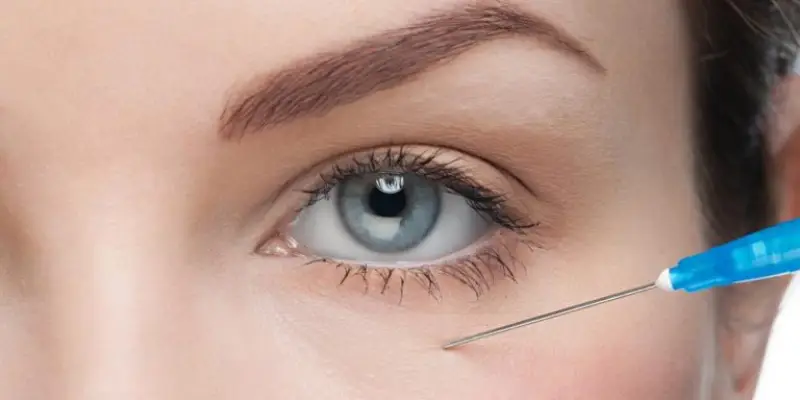 5 روش مؤثر برای درمان گودی زیر چشم