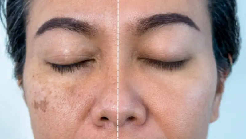 مراقبت های قبل و بعد از لایه برداری فتوشاپ صورت