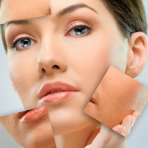 فتوشاپ پوست روشی برای پاکسازی و لایه برداری