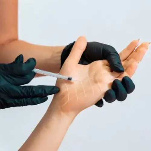 بوتاکس کف دست برای درمان تعریق بیش از حد ، مزایا ، عوارض